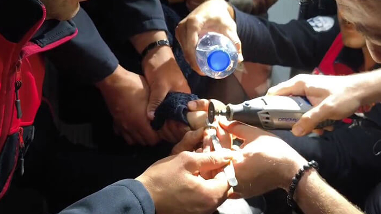 Parmağına sıkışan yüzük paniğe neden oldu: İtfaiye devreye girdi